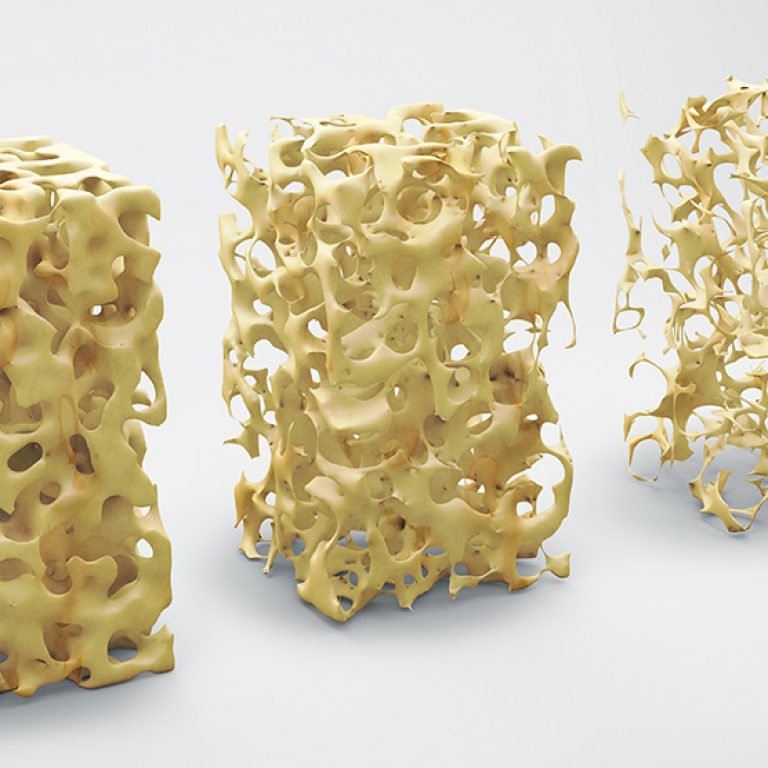 221020-Aca3-f2-huesos-sanos