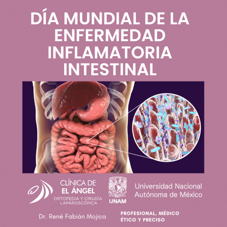 eii inflamatoria intestinal