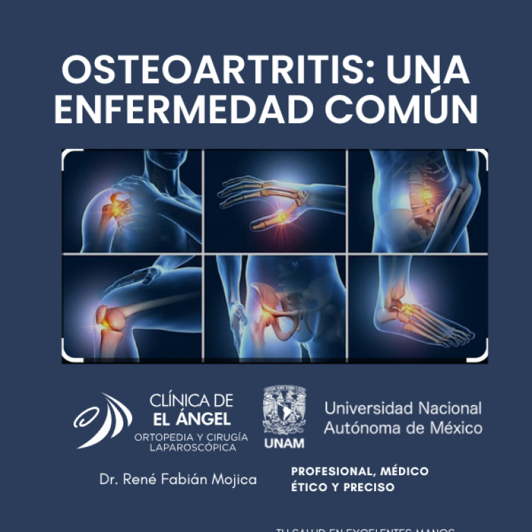 osteoartritis doctor traumatologo enfermedad (4)